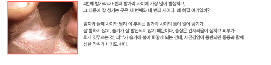 4��° �߰����� 5��° �߰��� ���̿� ���� ���� �߻��ϰ�, �� ������ �� ����� ���� �� ��°�� �� ��° ���̴�. �� ���� �����ϱ�? ������ ��° ���̿� �޸� �� ������ �߰��� ������ ƴ�� ���� ���Ⱑ �� ������ �ʰ�, ���Ⱑ �� �߻���� �ʱ� �����̴�. ������ ���������� ���ϰ� �Ǻΰ� ��� �������� ��. �Ǻΰ� ���⿡ �Ҿ� �Ͼ�� �Ǵ� �ǵ�, ���հ����� ���ݵǸ� ������ �Բ� ���� ���밡 ���⵵ �Ѵ�.