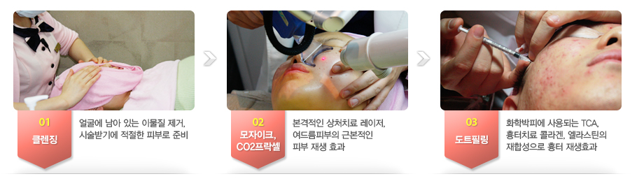 01.Ŭ��¡-�󱼿� ���� �ִ� �̹��� ����,�ü��ޱ⿡ ������ �Ǻη� �غ�. 
02.������ũ,CO2������-�������� ��óġ�� ������,���帧�Ǻ��� �ٺ����� �Ǻ� ��� ȿ��. 
03.��Ʈ�ʸ�-ȭ�й��ǿ� ���ȸ�� TCA,����ġ�� �ݶ��, ����ƾ�� ���ռ����� ���� ���ȿ��