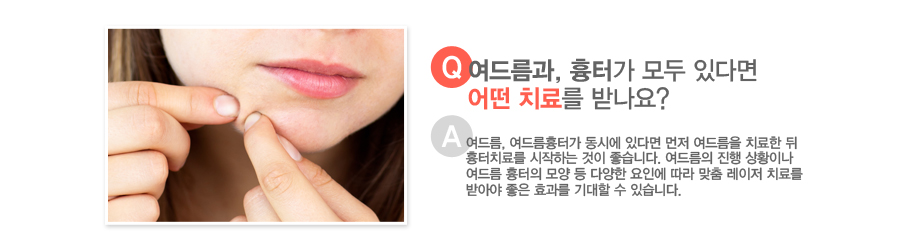 [����:���帧��, ���Ͱ� ��� �ִٸ� � ġ�Ḧ �޳���?][�亯:���帧, ���帧���Ͱ� ���ÿ� �ִٸ� ���� ���帧�� ġ���� �� ����ġ�Ḧ �����ϴ� ���� �����ϴ�. ���帧�� ���� ��Ȳ�̳� ���帧 ������ ��� �� �پ��� ���ο� ���� ���� ������ ġ�Ḧ �޾ƾ� ���� ȿ���� ����� �� �ֽ��ϴ�.]