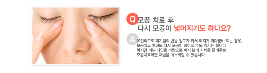 [����:��� ġ�� �� �ٽ� ����� �о����⵵ �ϳ���?][�亯:���������� �������� ���� ������ Ŀ�� ������ ���ٺк� �Ǵ� ���, ���ġ�� �Ŀ��� �ٽ� ����� �о��� ���� �ֱ�� �մϴ�. ������ �Ǻ� Ÿ���� �������� ���� �к� ��ü�� �ٿ��ִ� ���ġ���� ����� �ּ�ȭ�� �� �ֽ��ϴ�.]