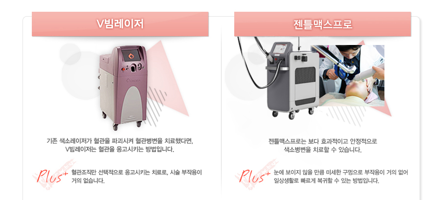 [���̴Ϸ��������/IPL]���̴Ϸ������� ������ ���Һ������� �ָ����������� ȿ������ �������Դϴ�.Plus:���̵��Ǻΰ��� ���̴Ϸ�������װ� IPL�� ���շ������� ȫ���� ġ���մϴ�.
[V��������]���� ���ҷ������� ������ �ı����� ���������� ġ���ߴٸ�,V���������� ������ ������Ű�� ����Դϴ�.Plus:���������� ���������� ������Ű�� ġ���, �ü� ���ۿ��� ���� �����ϴ�.