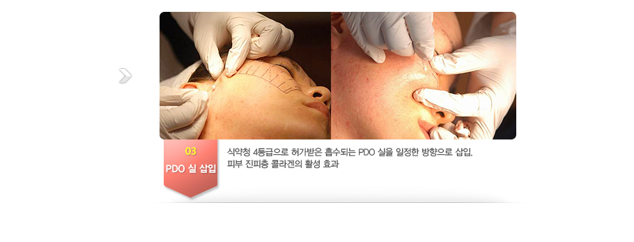 03.PDO �� ����-�ľ�û 4������� �㰡���� �����Ǵ� PDO ���� ������ �������� ����. �Ǻ� ������ �ݶ���� Ȱ�� ȿ��