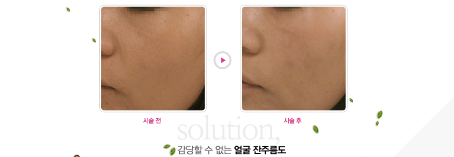 ������ �� ���� �� ���ָ���