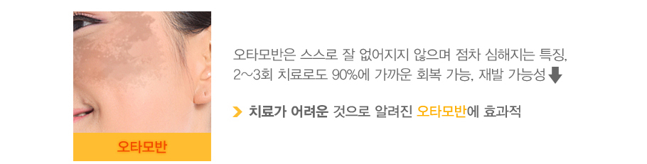 [��Ÿ���]��Ÿ����� ������ �� �������� ������ ���� �������� Ư¡.2~3ȸ ġ��ε� 90%�� ����� ȸ�� ����,��� ���ɼ����� (ġ�ᰡ ����� ������ �˷��� ��Ÿ��ݿ� ȿ����)