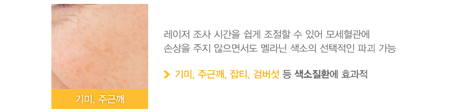 [���,�ֱٱ�]������ ���� �ð��� ���� ������ �� �־� �������� �ջ��� ���� �����鼭�� ���� ������ �������� �ı� ���� (���,�ֱٱ�,��Ƽ,�˹��� �� ������ȯ�� ȿ����)