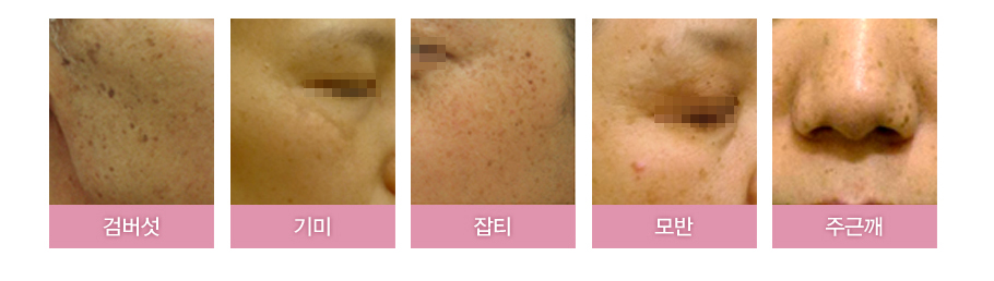 �˹���,���,��Ƽ,���,�ֱٱ�